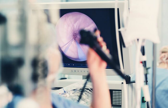 Badanie kolonoskopii w kierunku raka jelita grubego