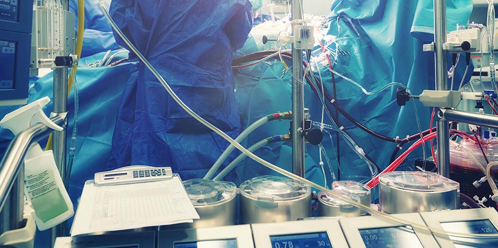 Płucoserce – urządzenie, które podczas operacji na otwartym sercu przejmuje funkcję serca przy użyciu pompy mechanicznej