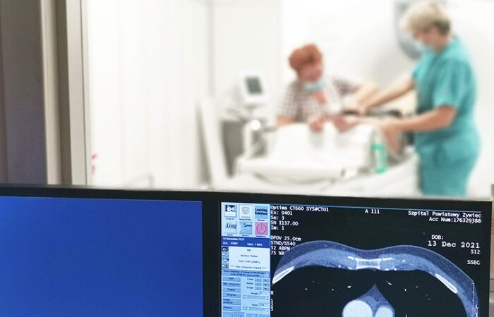 Tomografia komputerowa serca i naczyń wieńcowych w Szpitalu Żywiec