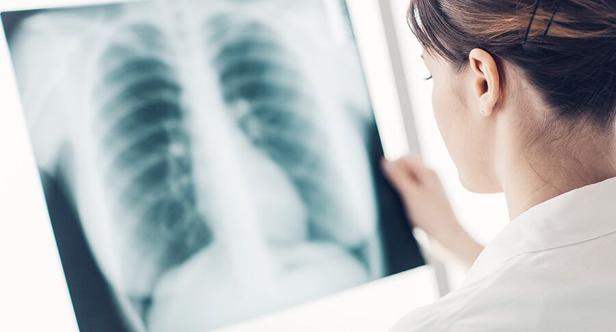 Lekarka ogląda prześwietlenie (rentgen) płuc na kliszy
