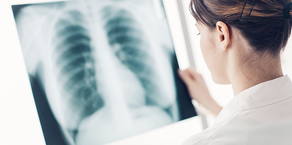 Lekarka ogląda prześwietlenie (rentgen) płuc na kliszy